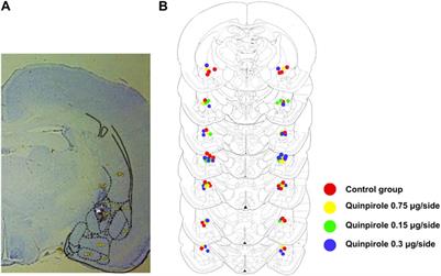 Evidence for the existence of facilitatory interactions between the dopamine D2 receptor and the oxytocin receptor in the amygdala of the rat. Relevance for anxiolytic actions